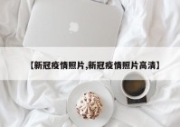 【新冠疫情照片,新冠疫情照片高清】